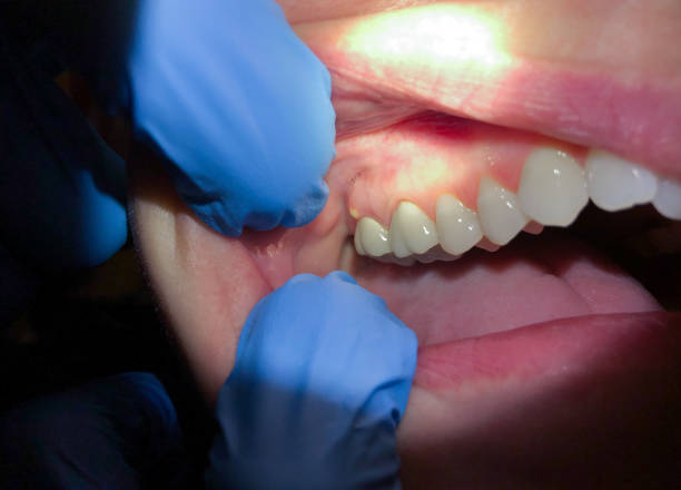 Best Emergency Cosmetic Dentistry in Dunn Loring, VA