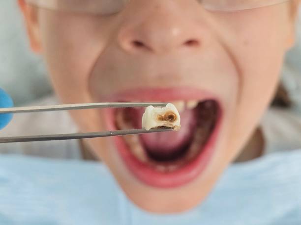Best Holiday Emergency Dentist in Dunn Loring, VA
